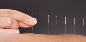 acupuncture york